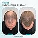 SURETHIK Hair Fibers, 15g (Medium Brown), Fills Thinning Hair for Visibly Fuller Look, Conceals Bald Spots, Natural Look, For Men & Women