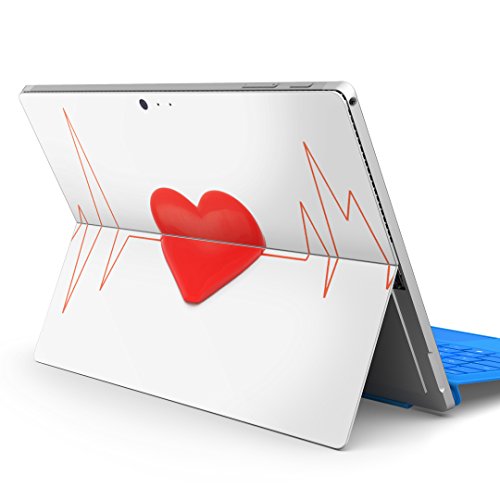 igsticker Surface pro7 (2019) pro6 pro2017 pro4 ��p �X�L���V�[�� �T�[�t�F�X �m�[�g�u�b�N �m�[�g�p�\�R�� �J�o�[ �P�[�X �t�B���� �X�e�b�J�[ �A�N�Z�T���[ �ی� 006161 ���u���[ �n�[�g �� ���b