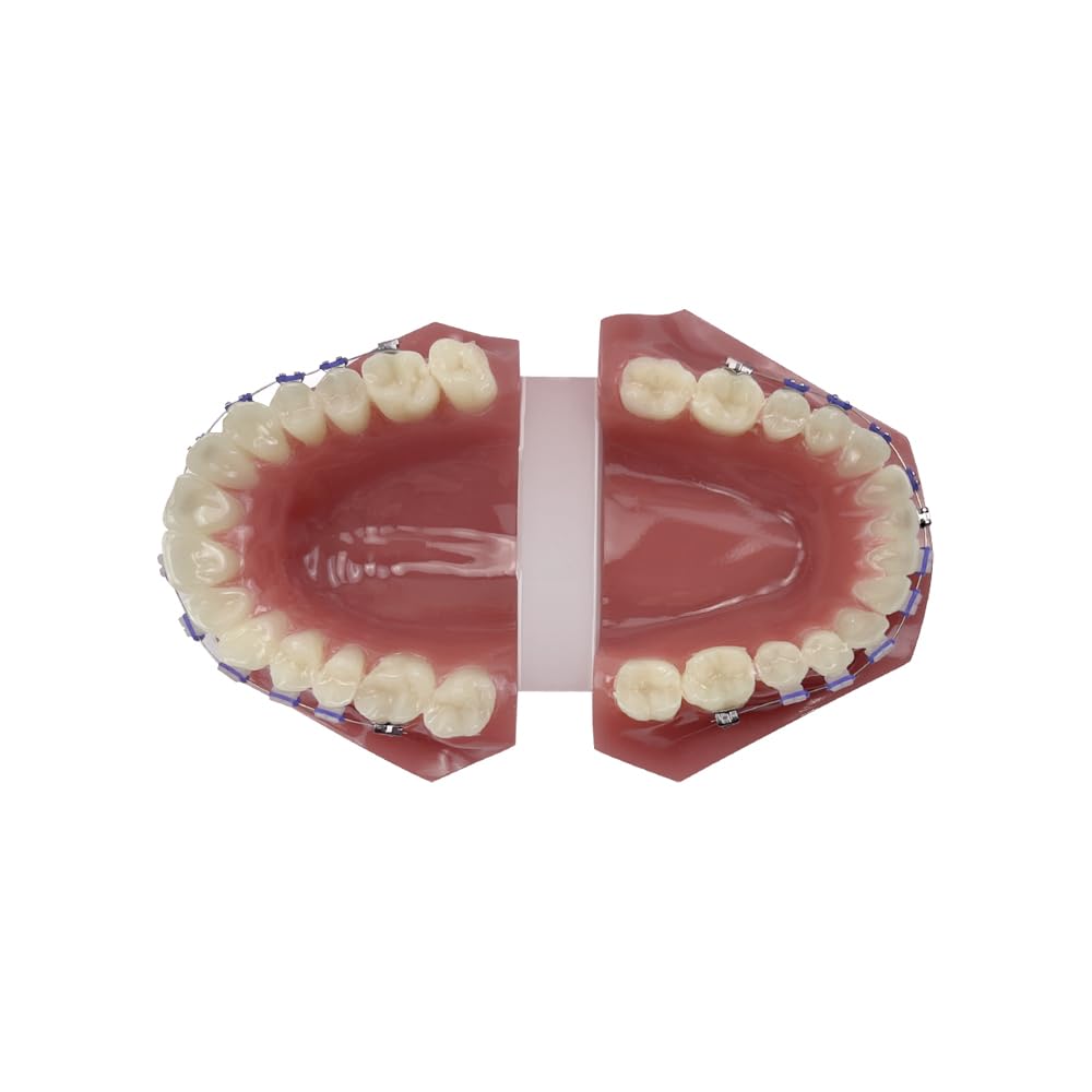 Orthodontisches Zahnmodell mit Halterungen, YOUYA DENTAL Demonstration Orthodontisches Modell für Bildung, Zähne Demonstration Typodonte Anatomisches Lehrwerkzeug mit Metall und Keramischer Halterung