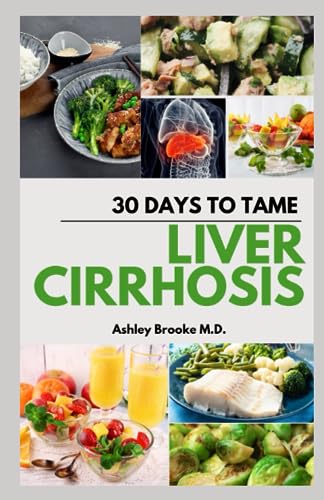 30 DAYS TO TAME LIVER CIRRHOSIS: The Fool-Proof Diet Guide to Manage, Treat and Reverse Liver Cirrhosis With 100+ Recipes for a Complete Liver Health