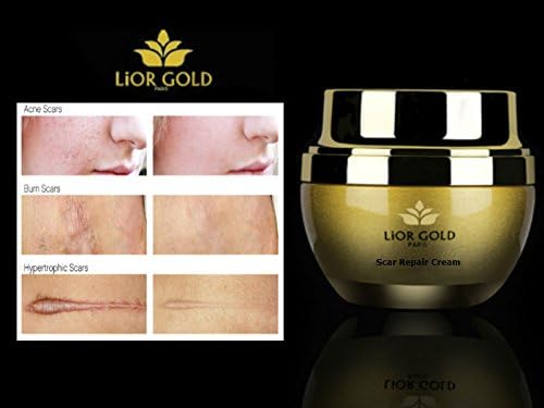 Scar Repair Cream