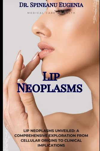 Lip Neoplasms Unveiled: A Comprehensive Exploration from Cellular Origins to Clinical Implications (Medical care and health)