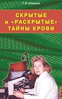 Hiding and "open" secrets of the blood. Its path to health / Skrytie i "raskrytye" tayny krovi. Svoya tropa k zdorovyu 5885039348 Book Cover