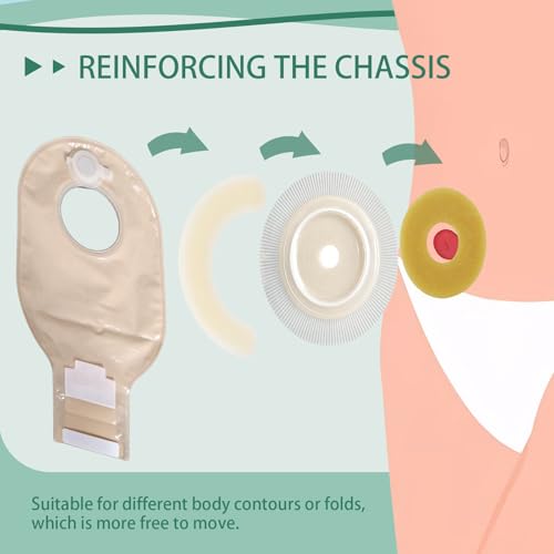 XIIFIIFII 30Pcs Ostomy Barrier Rings, 2mm Thickness Hydrocolloid Tape Cohesive Seals, Elastic Moldable Skin Extender, Ostomy Supplies for Colostomy, Ileostomy & Urostomy Bags