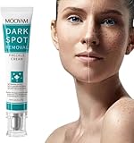 美白クリーム 医薬部外品 肝斑リペアクリーム 強力美白でしみ・そばかすを消す 色素沈着を修復して薄くする 肝斑治療 そばかす除去 炎症後色素沈着対策 メラニン抑制 ハリツヤ改善 高濃度美容成分配合