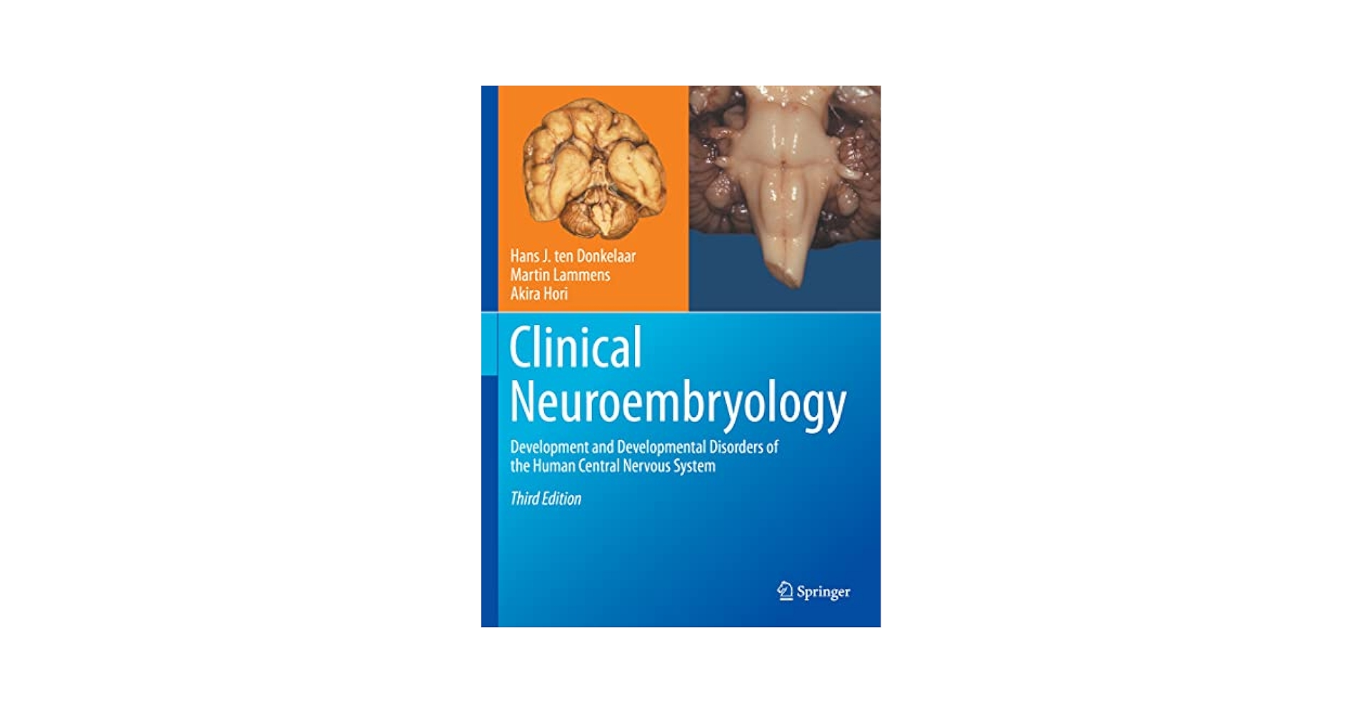Clinical Neuroembryology: Development and Developmental