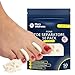 Premium Foam Toe Separators - Toe Spacers for Corn, Blisters, and Hammer Toe Relief - 1/4 Inch - Bulk Pack of 50 Toe Pads