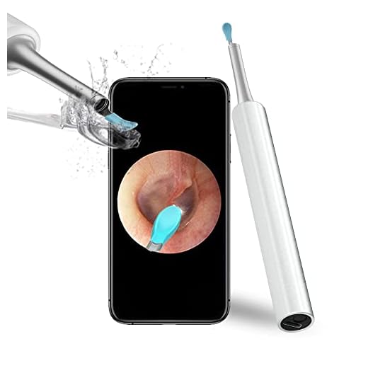 Ear Wax Removal Endoscope Otoscope, Earwax Remover Tools, Scope, with 1080P FHD Camera, 6 Led Lights, Wireless Connected, Compatible with iPhone, iPad, Android Smart Phones & Tablets, White