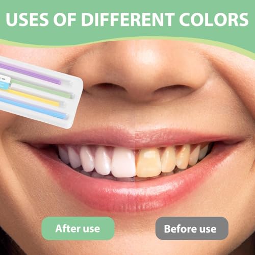 60 Stück Zahn Schleifpapier Dental Polierstreifen Zahnreinigung Zwischenräume 18×4.5×0.7mm Zahnschleifpapier Interdental Schleifwerkzeuge zum Polieren von Zähnen