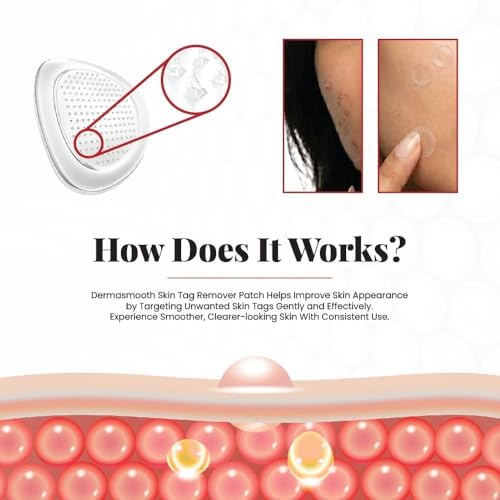 Image of Pack of 72 Derma Smooth Skin Tag Removal - 72 Patches | Gentle & Effective Skin Tag Remover for All Skin Types (72 Units Patchess)