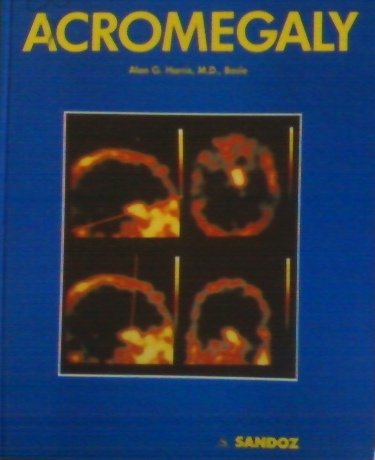 Acromegaly B000GKRA5W Book Cover