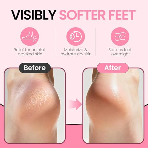 Image of Silicone Socks for Cracks for Women & Men - Moisturizing Spa Gel Socks for Dry Cracked Feet - Silicon Socks Heel Repair Foot Hydration Socks with Vitamin E, Jojoba & Olive Oil - Multicolor (1 Pair)