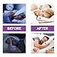 Sleep Patches, 28 Stück Schlafpflaster Stickers Relieve Anxiety And Fatigue Natürliche Schlafaufkleber Zur Verbesserung Der Schlafqualität, Verbesserte Tiefschlaf Patches Für Männer Und Frauen