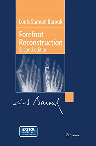 Forefoot Reconstruction view 2