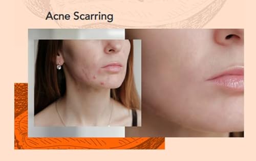 Lifecell Papaya Restorative Anti Aging Face And Body Wash 6Oz #TOP6