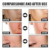 Zoom IMG-1 qingling crema para arrugas wrinkle Zoom IMG-1 qingling crema para arrugas wrinkle