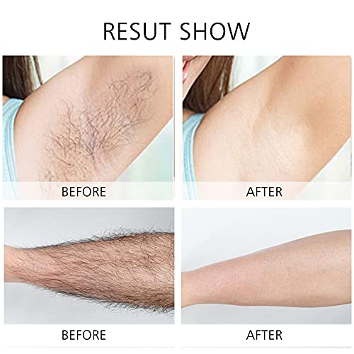 Women's Electric Shaver Replacement Heads : 5 Legs Hair Removal Razor Replacement Heads 4D Floating Heads Replacement Blades for Women