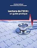 Lecture de l’ECG : un guide pratique
