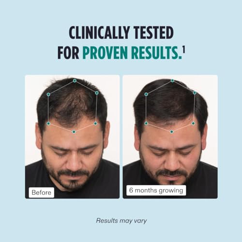 Nutrafol Men's Hair Growth Supplements, Clinically Tested for Visibly Thicker Hair and Scalp Covera