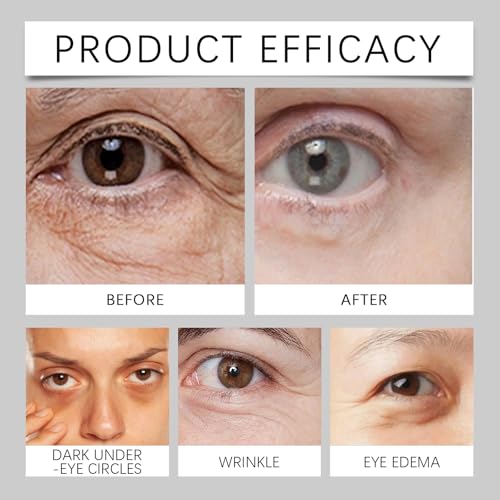 Bee-Venom Eye Cream, Eye Tightening Cream Instant, Bee-Venom Under Eye Cream for Dark Circles, Moisturising Cream for Eyes, Puffy Eyes Bags Under Eyes Treatment, Firming, Anti Wrinkles, Brightening - Image 5