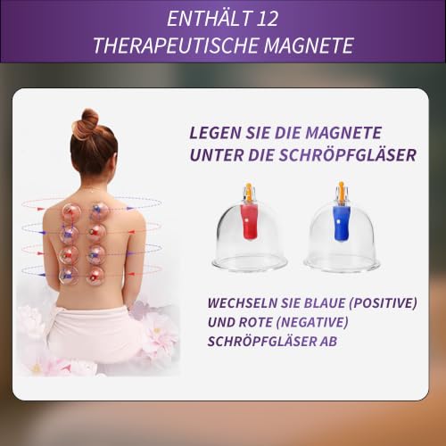 Uplife Schröpfgläser mit Vakuumpumpe - Schröpfset mit 24 Gläsern für Schröpfen & Cupping Therapie - Schröpfgerät & Massage Set… – Ansicht 5