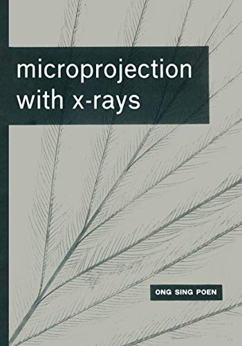 Microprojection with X-Rays view 2