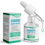 Fcoget Acne Spot Treatment Serum for Face, with 2% Salicylic Acid & 4% Niacinamide Face Serum, Liquid Pimple Patch for Acne Prone Skin, Soothing Redness, Clearing Oil Skin Care for Teens & Adults