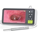 AnyScope 1080P Digital Otoscope with Gyroscope, 3.9mm Ear Scope Camera with 6 Lights, 4.5 Inches Screen, Ear Wax Removal Tool, 32GB Card, Supports Photo Snap and Video Recording