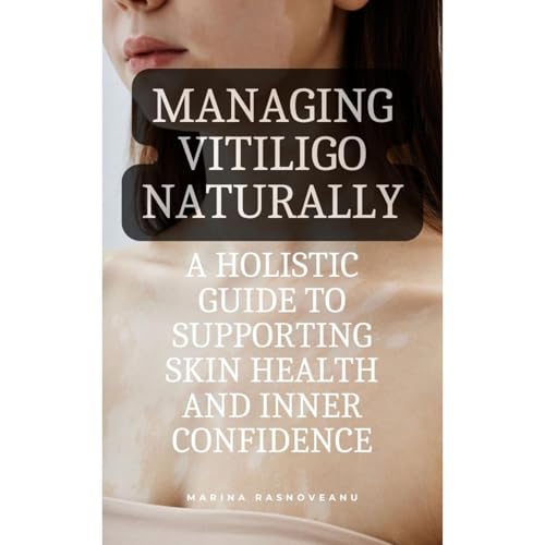 Managing Vitiligo Naturally: A Holistic Guide to Supporting Skin Health and Inner Confidence Audiolibro Por Marina Rasnoveanu