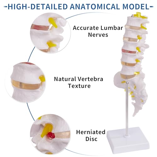 Image of Lumbar Spine Model for Anatomy Education, Life Size Human Lumbar Model with 5 Vertebrae Sacrum, Spinal Disc, and Sturdy Base, Ideal Tool for Medical Teaching and Learning