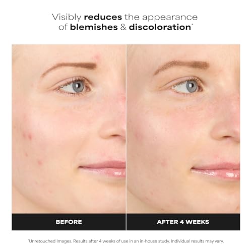 Image of Paula's Choice BOOST 10% Azelaic Acid Booster Cream Gel Face Serum with Salicylic Acid, Minimizes Look of Redness & Fades Discoloration, Oil-Free Skin Brightening Serum for Face, Fragrance-Free