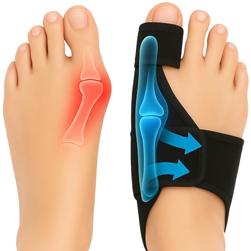 benoo Correttore per Alluce Valgo Donna Uomo – Divaricatore Regolabile,