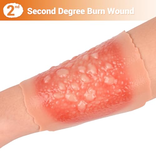 Image of Burn Wound Packing Trainer, Burn Moulage, Adhesive Skin Burn Wound Trainer for Wound Care Training, Second Degree Burn Wound Training Model