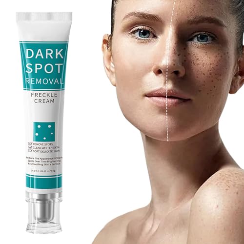 ARCHIDATE Dark Spot Remover Cream - Pigmentflecken entferner Gesicht Cream - Niacinamid Freckle Creme - Gesichtspflege Gesichtscreme Damen - Dunkle Flecken Entferner für Gesicht Feuchtigkeitscreme