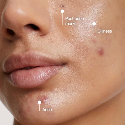 Neutrogena Evenly Clear Acne Cleansing Face Mask, 4.2 fl. oz - image 8