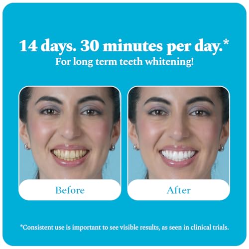 Image of Perfora Teeth Whitening Strips - Pack of 14 Treatments (28 Strips) - Whitens Teeth in 1 Use | Sensitivity-Free, Enamel-Safe Oral Care | PAP & Hydroxyapatite for Stain Removal | Fast & Effective Teeth Whitening Products