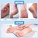 Electric Feet Callus Removers Rechargeable-Foot Scrubber Kit, Wireless Foot File with Metal 2 Grinding Head,3-Speed Pedicure Tools for Feet, Ped Egg for Dead Skin Heels and Hard Cracked Dry Skin