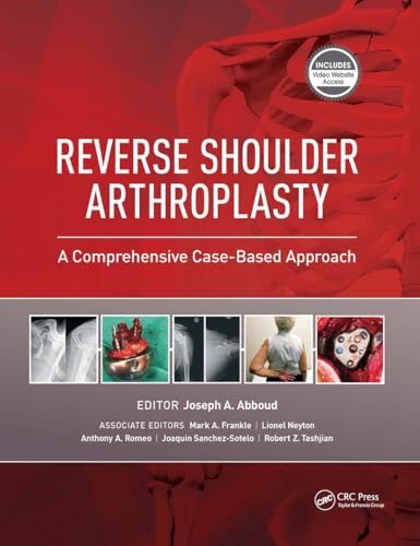 Reverse Shoulder Arthroplasty: A Comprehensive Case-Based Approach view 2