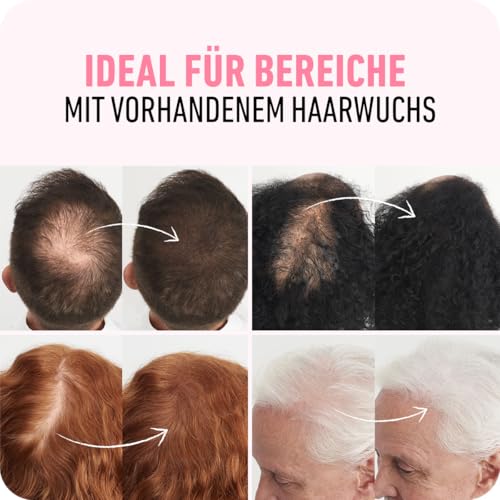BOLDIFY Streuhaar für Dünner Werdendes Haar (Schwarz), Unsichtbar, Natürlich, Große Flasche, 28g, Kaschiert Haarausfall in 15 Sek, Haarverdichtung, Haarpuder für Feines Haar, Frauen/Männer