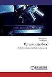 Ectopic decidua: Pathohistological and clinical aspects