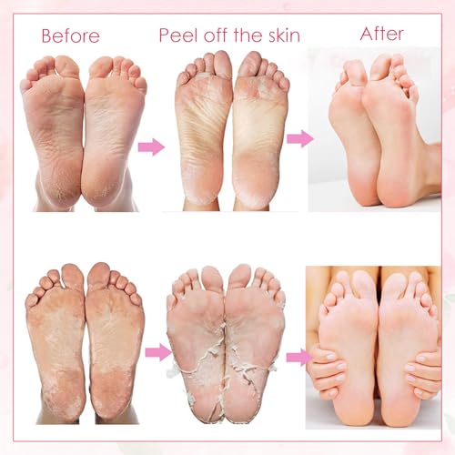 Mascarilla para pies, paquete de 2 calcetines para callos, calcetines para quitar callos, melocotón, repara los talones y elimina los callos secos de los pies muertos, calcetines anticallos - imagen 6