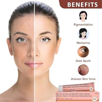 NG Glow Cream [ Pack of 2 ]