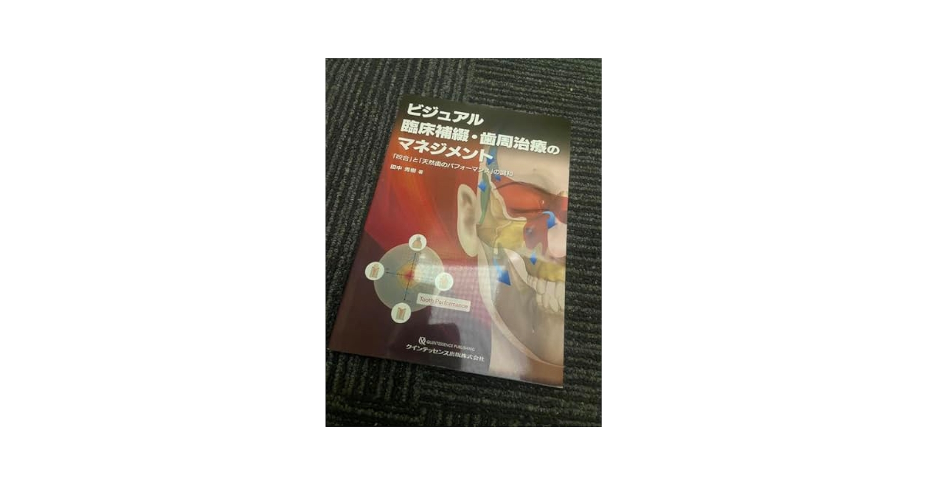 ビジュアル 臨床補綴・歯周治療のマネジメント 「咬合」と「天然歯のパフォーマン… Amazon.co.jp: ビジュアル 臨床補綴・歯周治療のマネジメント