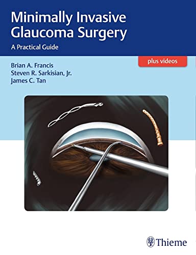 Minimally Invasive Glaucoma Surgery: A Practical Guide view 2