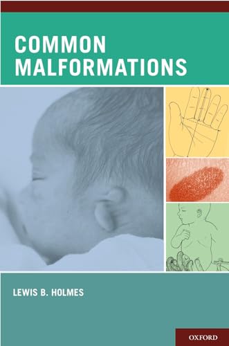 Common Malformations view 2