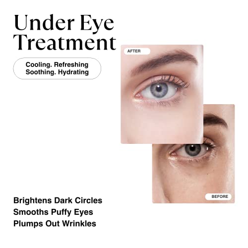MATKAS Korean Gold Under Eye Patches for Dark Circles and Puffiness, Wrinkles - Retinol + Hyaluronic Acid + Collagen + Niacinamide, Under Eye Mask Puffy Eyes Treatment for Women Skin Care - Thumbnail 2