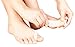 Protectores y Separadores de Gel | Corrector de Juanetes (Hallux Valgus) y Separadores de Dedos de los Pies 2 en 1 | Ayudan a alinear el dedo gordo del pie para adoptar una posición más natural