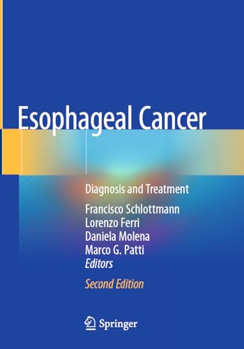 Esophageal Cancer: Diagnosis and Treatment