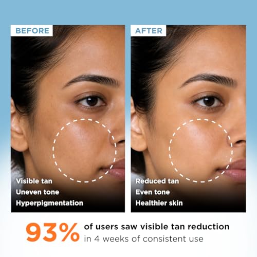 Image of Clarity Labs | DETAN BRIGHTENING SOAP | (Pack of 4) | Tan Removal | KOJIC ACID SOAP | Niacinamide | Vitamin C Kojic | Dark Spot Removal | Even Skin Tone | Glowing Brighter Skin | Reduces underarm pigmentation