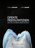  Direkte Restaurationen im Seitenzahnbereich
